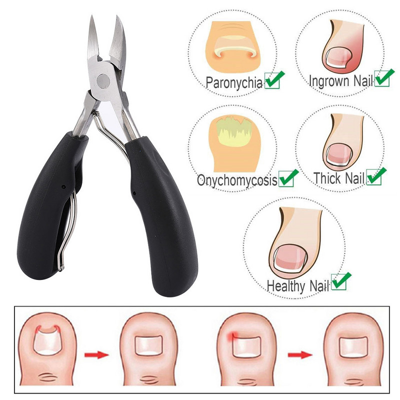 1 vnt Stori nagai Įaugę kojų nagai Žnyplės Žirklės kojų nagų kirpimo mašinėlės Nagų korekcija Negyvos odos nešvarumų valiklis Pedikiūro priežiūros priemonė