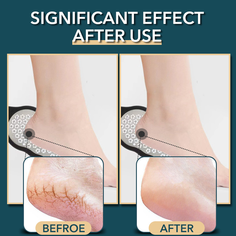 1 buc 304 din oțel inoxidabil pentru îndepărtarea calusului pedichiură picior răzuitor Scrubber portabil multifuncțional picior picior instrumente de îngrijire