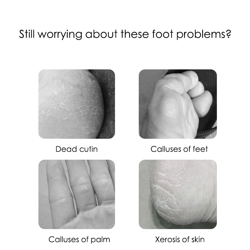 Set pedichiură Peeling și exfoliere calusuri Perie pentru frecat picioarele din oțel inoxidabil Piatră de îngrijire a picioarelor pe două fețe 10 în 1