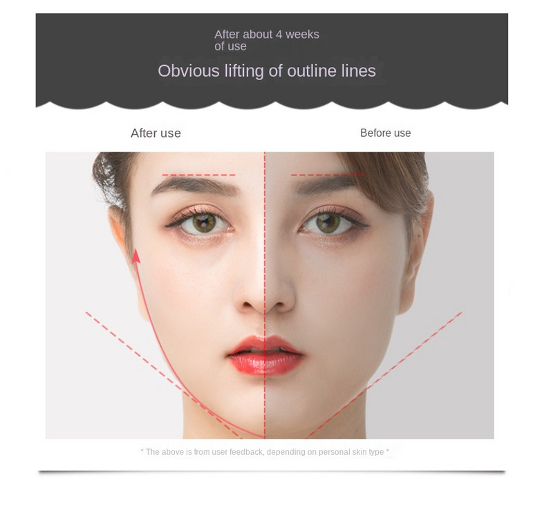 Roller Face Slimmer Facial EMS mikroáramú masszázs szépségápolási műszerekSmall V Face Emeli, feszesíti, formálja és csökkenti a ráncokat