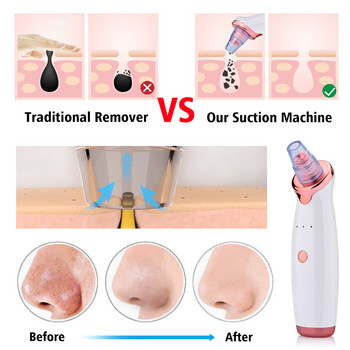 Facial Remover Electric Acne Cleaner Blackhead Black Point Vacuum Cleaner Εργαλείο καθαρισμού πόρων μαύρων κηλίδων Μηχάνημα καθαρισμού πόρων