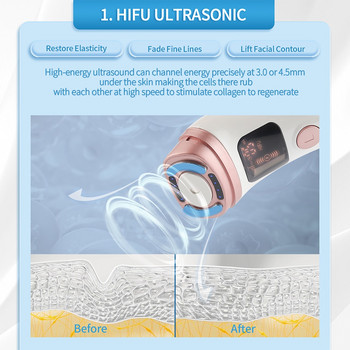 Mini HIFU Machine Ultrasonic RF EMS HIFU Facial Lifting Skin Tightening device Face Chin Neck Eye Αντιρυτιδικό μασάζ Οικιακή χρήση