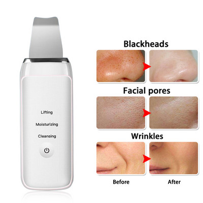 Scrubber de curățare a feței cu ultrasunete reîncărcabil pentru curățarea feței Peeling pentru piele Îndepărtarea punctelor negre Dispozitiv de curățare a porilor Scrubber de față