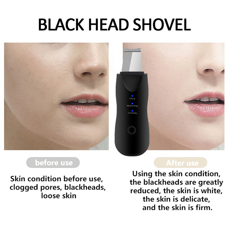 Scrubber cu ultrasunete pentru piele + Curățător electric de pori pentru îndepărtarea punctelor negre + Aburire de față cu spray Nano + instrument de masaj facial + Frumusețea ochilor