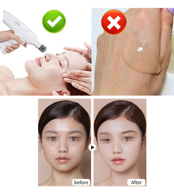 ΝΕΟ Wireless Beauty Mesotherapy Gun Microneedling Water Injector Stem Cell Therapy Skin Rejuvenation Microcrystal Injector