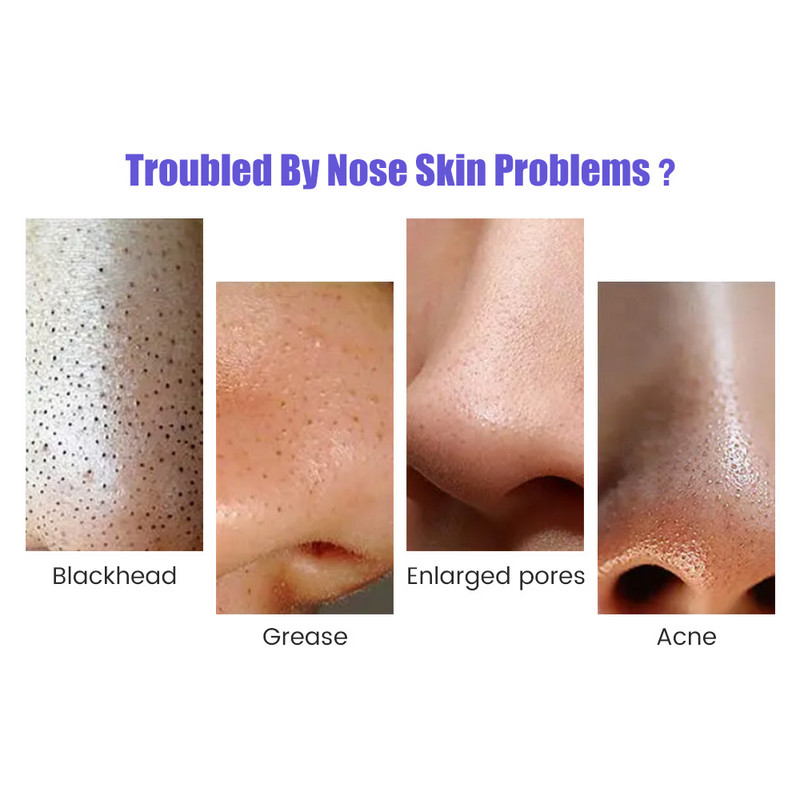 Dispozitiv de îndepărtare a punctelor negre USB Diamond Dermabrasion Naz Vacuum Pore Cleanser + Dispozitive de ridicare pentru terapie cu lumină facială Masaj vibrant pentru față