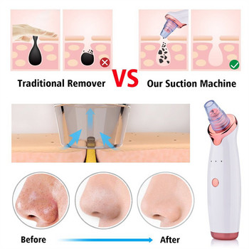 Electric Remover Pore Cleaner Deep Nose Cleaner T Zone Pore Acne Αφαίρεση σπυριών προσώπου Pimple Acne Comedone Extractor