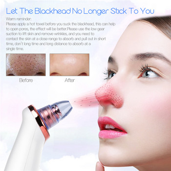 CkeyiN Electric Remover Blackhead Vacuum Facial Acne Cleaner Συσκευή καθαρισμού πόρων για σπυράκια Black Nose Point Beauty Skin Care Tool