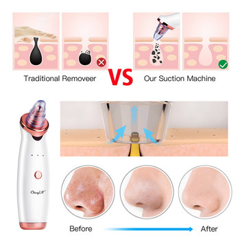 CkeyiN Electric Remover Blackhead Vacuum Facial Acne Cleaner Συσκευή καθαρισμού πόρων για σπυράκια Black Nose Point Beauty Skin Care Tool