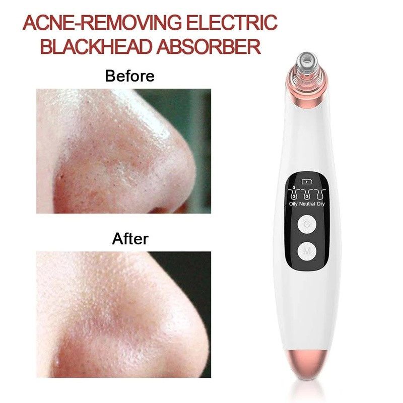 Ultrahangos bőrradír vibrációs arc spatula mitesszer eltávolító arcradír lapát Tiszta kavitációs peeling arc lifting