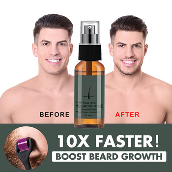 Natural Men Beard Growth Essence Спрей Балсам за лечение на косопад Поддържан Бърз растеж на брада Поддръжка