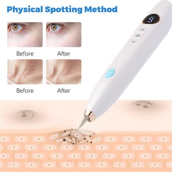 9 Mode Pen Plasma Freckle Remove Pen Wart Remover Mole Tattoo Remover Instruments Skin Tag Removal Spot Cleaner Beauty Care Tool