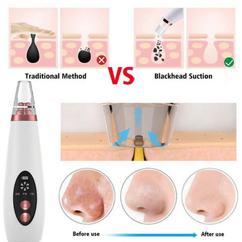 Επαναφορτιζόμενο USB Remover Blackhead Face Pore Skin Care Skin Cleaner Ακμή Πόρων Αφαίρεση σπυριών Εργαλεία αναρρόφησης με ηλεκτρική σκούπα