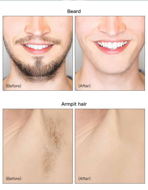 2 viename vyriškas epiliatorius vandeniui atsparus privačių dalių plaukų šalinimo aparatas Bikini moterims gaktos plaukų skustuvas Vyriškas kirkšnių kirptuvas