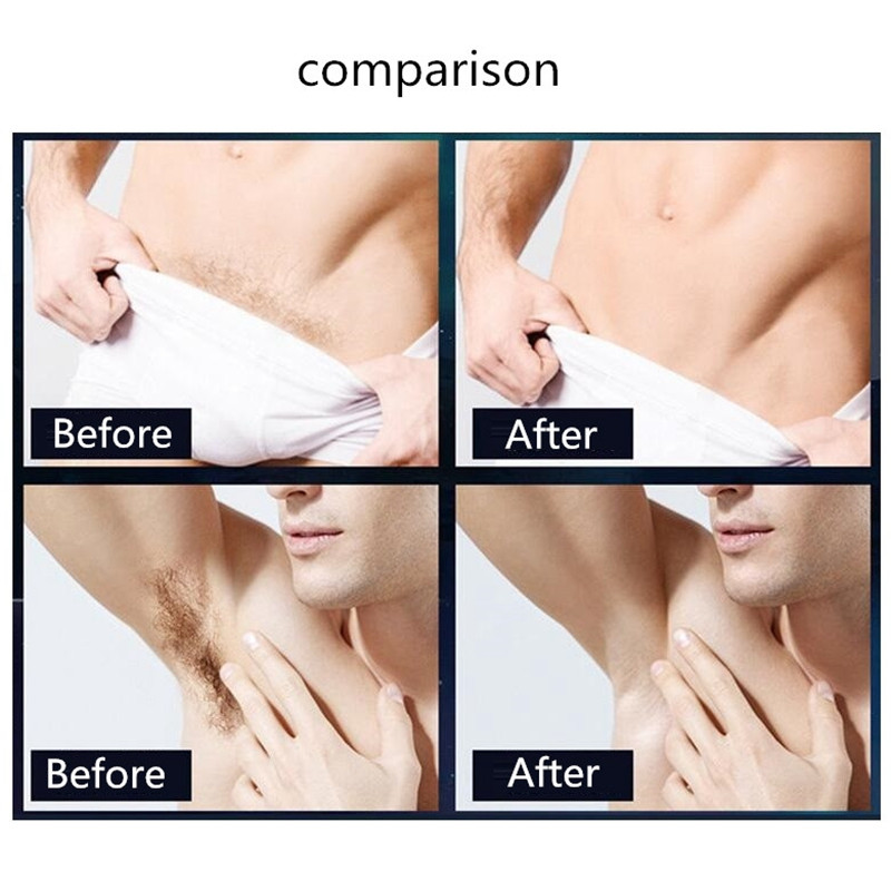 Îndepărtarea părului pubian Zone intime Locuri parte tunsoare Mașină de tuns aparat de tuns pentru epilatorul inghinal aparat de ras de siguranță bărbierit