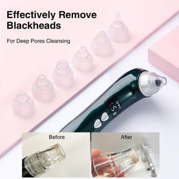 Visual Electric Facial Remover Blackhead with Camera Vacuum Acne Cleaner Αφαίρεση Μαύρων Κηλίδων Deep Cleansing Skin Pore Cleaner