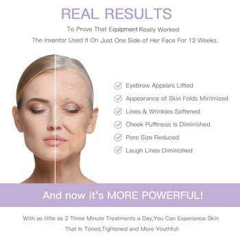 Face Beauty Pen RF Mesotherapy Microcurrent Skin Tightening Face Lifting Ραδιοσυχνότητα Αντιρυτιδική θεραπεία με κόκκινο φως Περιποίηση δέρματος