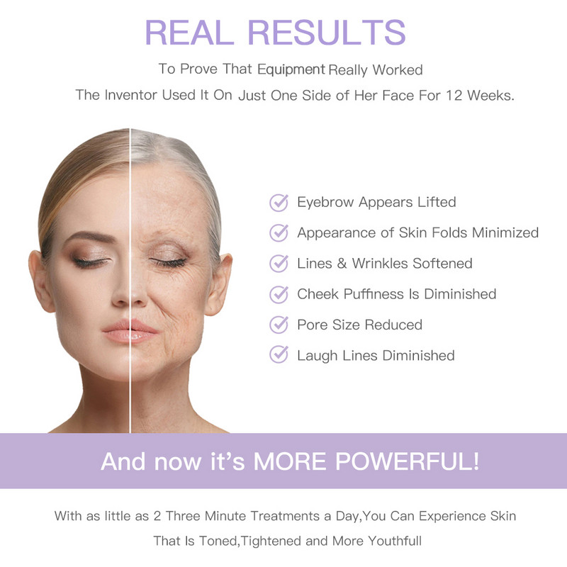 Face Beauty Pen RF mezoterápia mikroáramú bőrfeszesítő arc lifting rádiófrekvenciás ránctalanító vörös fényterápiás bőrápoló