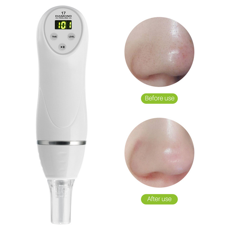 6 tipp Arcbőrápolás Beauty Device Skin Diamond dermabrázió Heg eltávolítása Akne Pórus hámlasztó gép Masszírozó Mikrodermabrázió