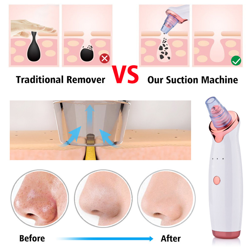 Mitesszer eltávolító arc mély orrtisztító T zóna pórus pattanás pattanás eltávolító vákuum szívás arcápoló nano Beauty Clean bőrápoló eszköz
