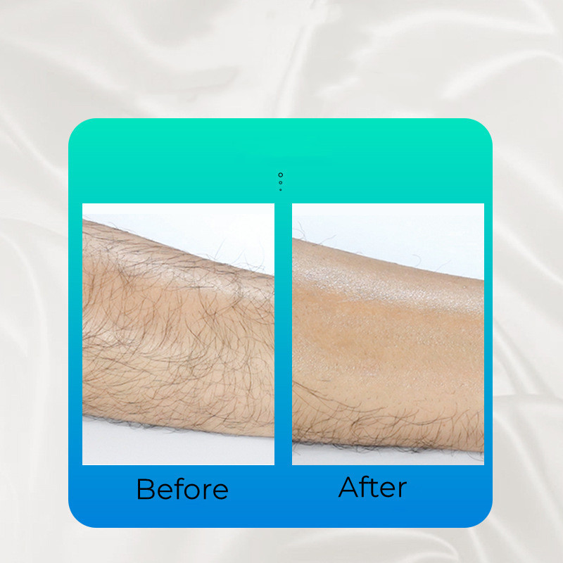 Hot New Ανώδυνα Φυσική Αποτρίχωση Αποτρίχωση Crystal Erase Ασφαλής Εύκολος Μόνιμος Καθαρισμός Επαναχρησιμοποιούμενο εργαλείο αποτρίχωσης σώματος Beauty