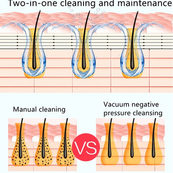 Αφαίρεση μαύρων στιγμάτων Προσώπου Καθαρισμός Πόρων Βαθιάς Μύτης Κυκλοφορία Νερού Ακμή Αφαίρεση Ακμής Αναρρόφηση Αναρρόφηση Προσώπου Εργαλείο καθαρισμού δέρματος