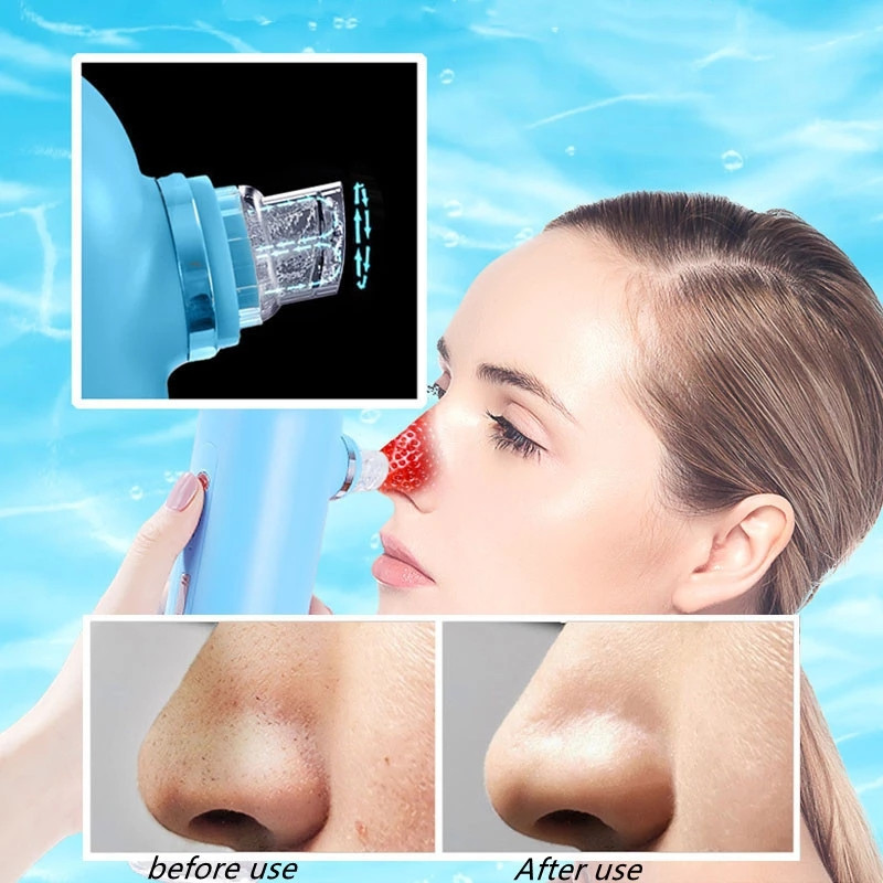 Îndepărtarea punctelor negre Facială Curățarea porilor nasului adânc Circulația apei Acnee Îndepărtarea acneei Aspirație cu vid Instrument pentru curățarea feței pentru piele