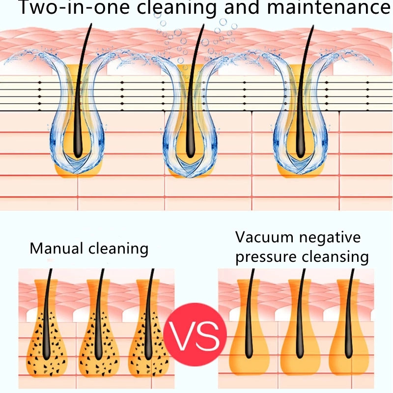 Îndepărtarea punctelor negre Facială Curățarea porilor nasului adânc Circulația apei Acnee Îndepărtarea acneei Aspirație cu vid Instrument pentru curățarea feței pentru piele