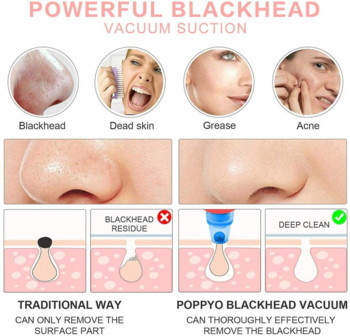 Electric Remover Pore Vacuum USB Επαναφορτιζόμενη ηλεκτρική σκούπα Blackhead Extractor Pore Skin Remover Beauty Tools