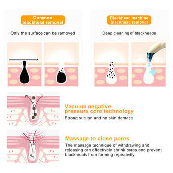 Ηλεκτρική συσκευή αφαίρεσης μαύρων στιγμάτων Καθαριστικό για πόρους Καθαριστικό ακμής Καθαριστικό για μαύρο σημείο καθαρισμού ηλεκτρικής σκούπας Comedone Pore Cleaner Beauty Instrument