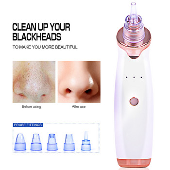 Facial Remover Electric Acne Cleaner Blackhead Black Point Vacuum Cleaner Tool Pore Cleaner Μηχάνημα καθαρισμού προσώπου