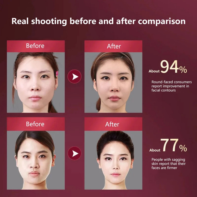 Dispozitiv de ridicare a feței V Masaj EMS pentru bărbia dublă Îndepărtați în formă de V Gua sha din oțel inoxidabil Masaj facial pentru strângere a pielii