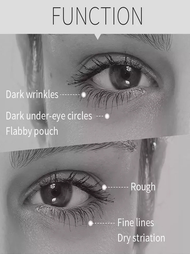 Rádiófrekvenciás bőrfeszesítő arcmasszírozó készülék Ránctalanító EMS Face Lifting Eye arcmasszírozó LED foton bőrápoló gép