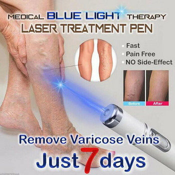 Лазерна писалка за премахване на бръчки от акне Премахване на петна по кожата Антиварикозно лечение на изтриване на паякообразни вени Преносима медицинска терапия със синя светлина
