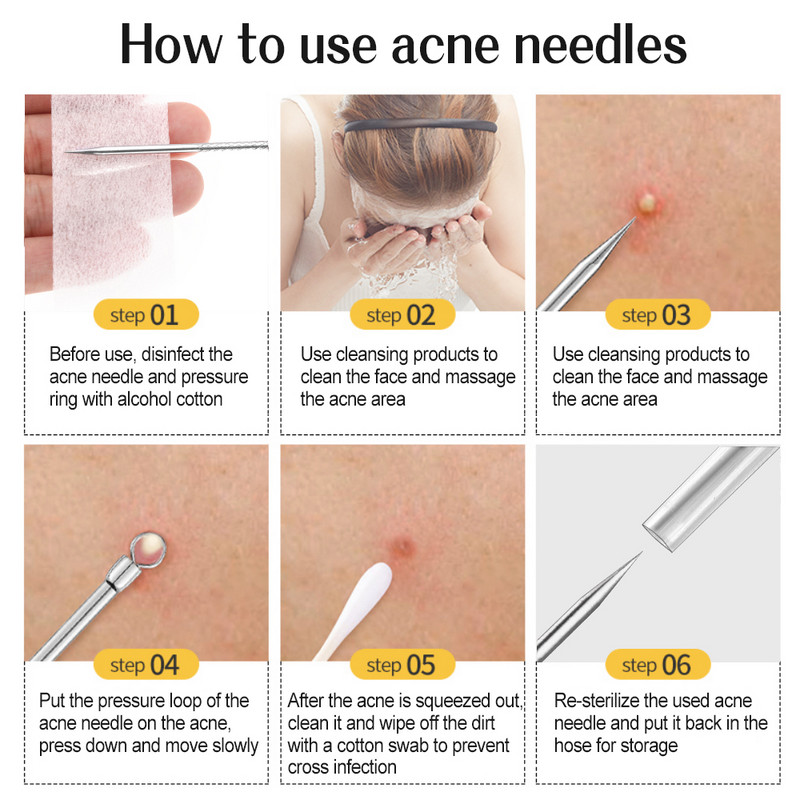 8/7/5 DB Akne mitesszer eltávolító tűk Black Dots Cleaner Black Head Pore Cleaner mélytisztító eszköz Arc bőrápoló eszköz