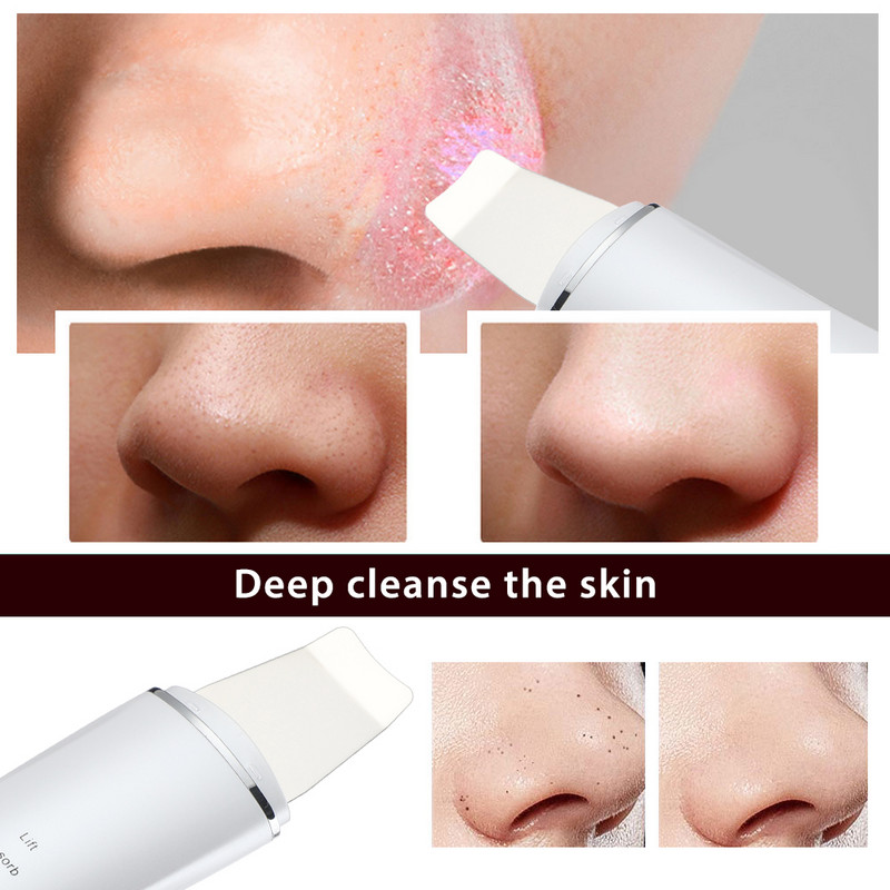 EMS ultrahangos bőrradír vibrációs arc spatula peeling lapát ion akne mitesszer eltávolító tiszta kavitációs arcmasszírozó