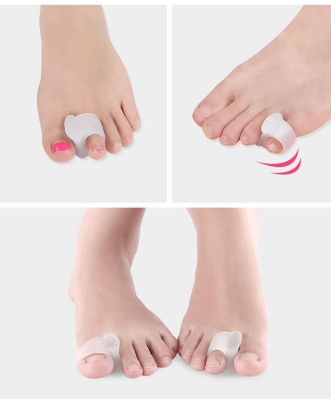 2 vnt. Silikoniniai pirštų atskyriklis kaulo ektropiono reguliatorius pirštų išorinis prietaisas Big Hallux Valgus korektorius pėdų priežiūros įrankiai