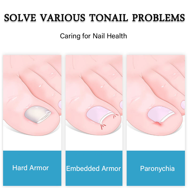 Dispozitiv profesional de tăiere a unghiilor pentru degetele de la picioare Instrument pentru unghii încarnate Unghii groase Dispozitiv de îndepărtare a murdăriei pentru piele moartă Instrument pentru unghii cu lamă curbă super ascuțită