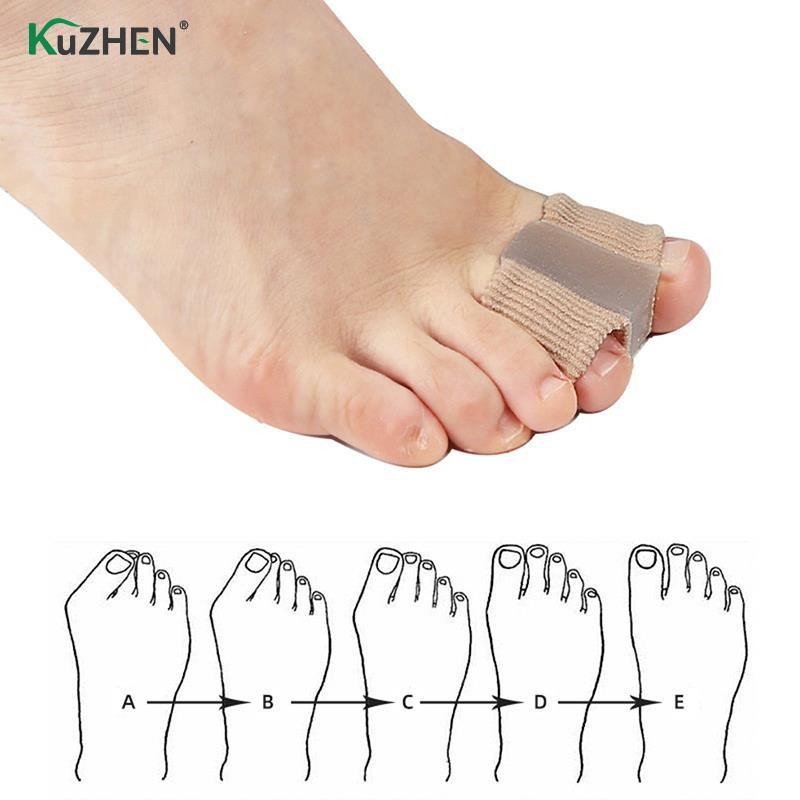 Silikoninis pirštų atskyrimo įtaisas „Bunion Hallux Valgus Corrector Thumb Foot Care“ Ortopedinis pirštų pirštų atskyriklis.