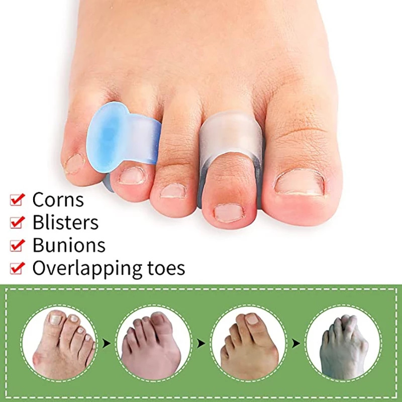 4db=2 pár szilikon lábujjleválasztó ujj lábápoló gél lábujj ortopéd bunion Hallux Valgus korrektor pedikűr távtartó