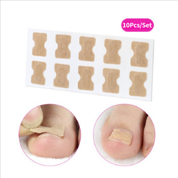 Αυτοκόλλητο Ingrown Nail Corrector Strap Anti-roll Nail Free Glue Toe Inlay Nail Corrector Patch Διόρθωση Αυτοκόλλητα Νύχι