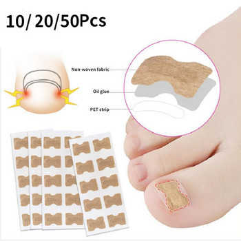 Αυτοκόλλητο Ingrown Nail Corrector Strap Anti-roll Nail Free Glue Toe Inlay Nail Corrector Patch Διόρθωση Αυτοκόλλητα Νύχι