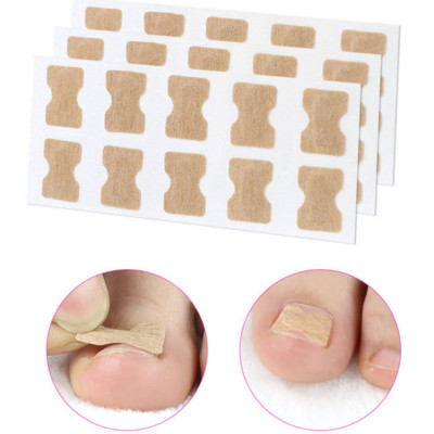 Αυτοκόλλητο Ingrown Nail Corrector Strap Anti-roll Nail Free Glue Toe Inlay Nail Corrector Patch Διόρθωση Αυτοκόλλητα Νύχι