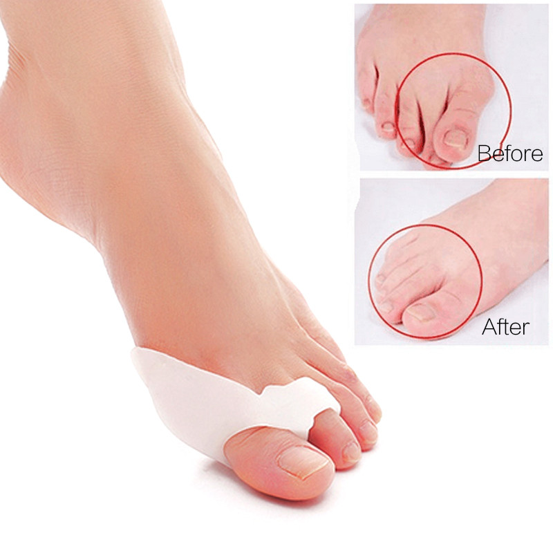 Corector al degetului osos Instrumente de îngrijire a picioarelor Corector de bunion Separatoare de degete Hallux Valgus Stretcher Corectarea degetului mare