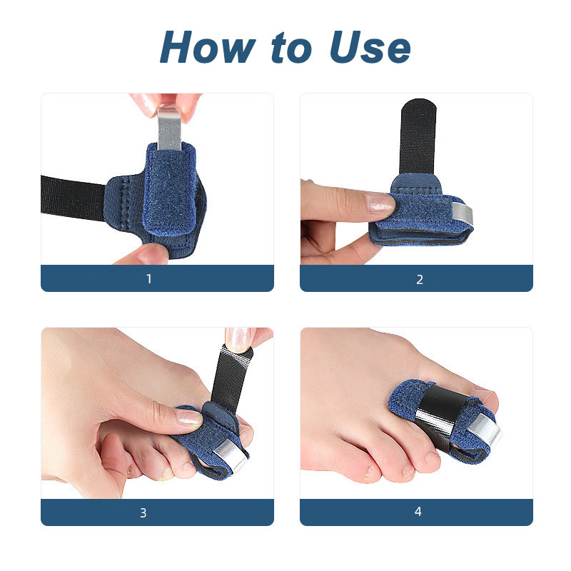 Pexmen 1/2 tk varvaste varvassirgendaja varbamähis painutatud küünise ja kõvera varba jaoks varvaste joondamiseks ja toetamiseks