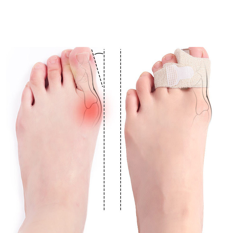Pexmen 1/2Pcs Bunion Corrector Toe Omotači za slomljene nožne prste Gel Buddy Tape Odvajači nožnih prstiju Zavoji Steznica za preklapajuće nožne prste