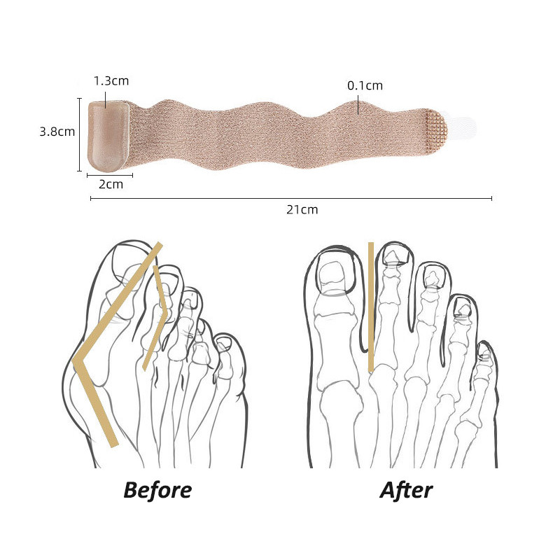 Pexmen 1/2Pcs Bunion Corrector Toe Omotači za slomljene nožne prste Gel Buddy Tape Odvajači nožnih prstiju Zavoji Steznica za preklapajuće nožne prste