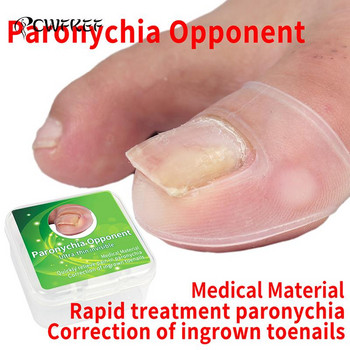 Εργαλείο διόρθωσης σιλικόνης Ingrown Toe Nail Treatment Elastic Ingrown Toe Nail Treatment Elastic ισιωτικό κλιπ Σιδεράκι για πεντικιούρ 2τμχ