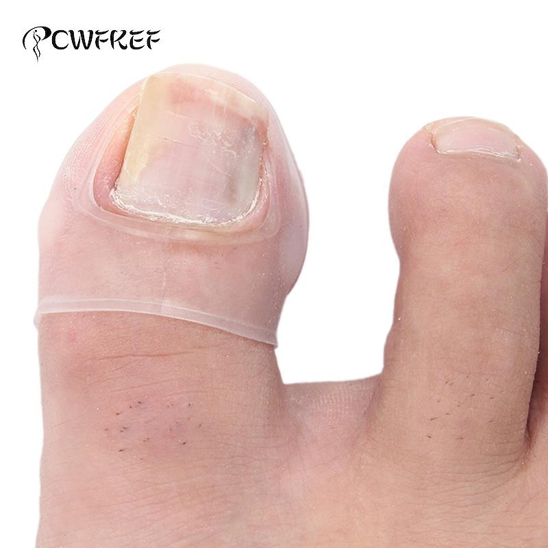 Silikonski alat za korekciju uraslog nokta Nevidljivi tretman uraslog nokta Elastična kopča za ravnanje Steznica Alat za pedikuru 2 kom