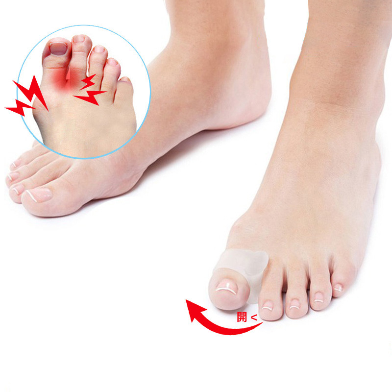 2db=1pár szilikon gél nagylábujj elválasztó bunion állító lábujjak protektor Csont Hallux Valgus Corrector lábápoló pedikűr